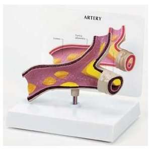  Artery Model 