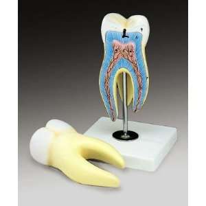   Classic Classroom Human Molar Tooth Model