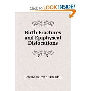   Fractures and Epiphyseal Dislocations Edward Delavan Truesdell Books