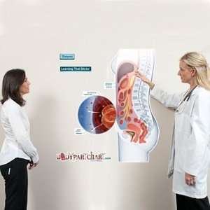  Dialysis Labeled Sticky Anatomy Wall Chart Health 
