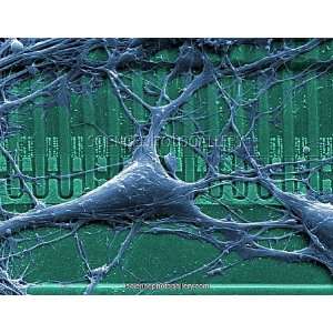  Neurochip, SEM Framed Prints